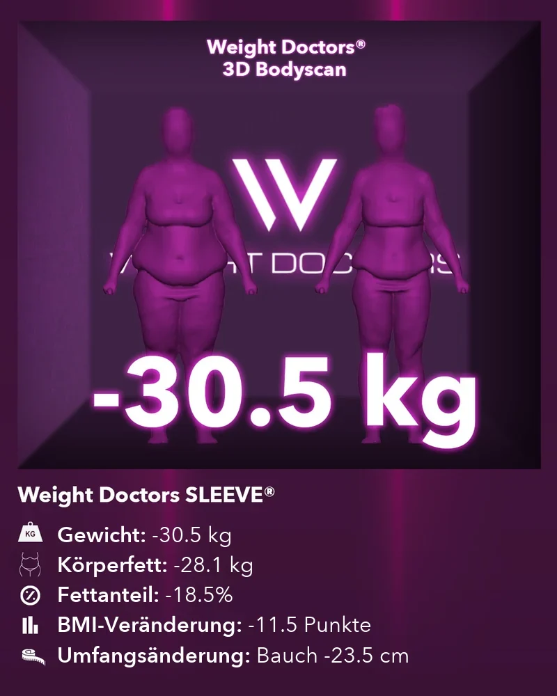 Weight Doctors® 3D-Bodyscan vorher und nachher: minus 30,5 kg mit Weight Doctors SLEEVE®, Körperfett minus 28,1 kg