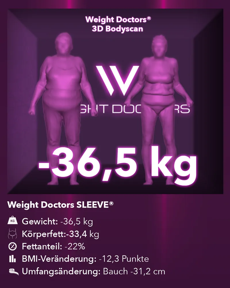Weight Doctors® 3D-Bodyscan vorher und nachher: minus 36,5 kg mit Weight Doctors SLEEVE®, Körperfett minus 33,4 kg