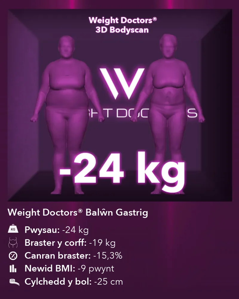 Weight Doctors® 3D Bodyscan cyn ac ar ôl: minws 24 kg gyda’r Weight Doctors® BALŴN GASTRIG, braster y corff minws 19 kg