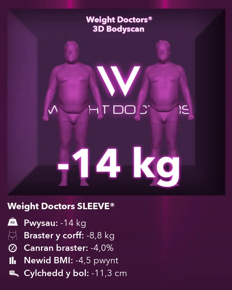Weight Doctors® 3D Bodyscan cyn ac ar ôl: 14 kg yn llai gyda Weight Doctors SLEEVE®, 8.8 kg yn llai o fraster y corff