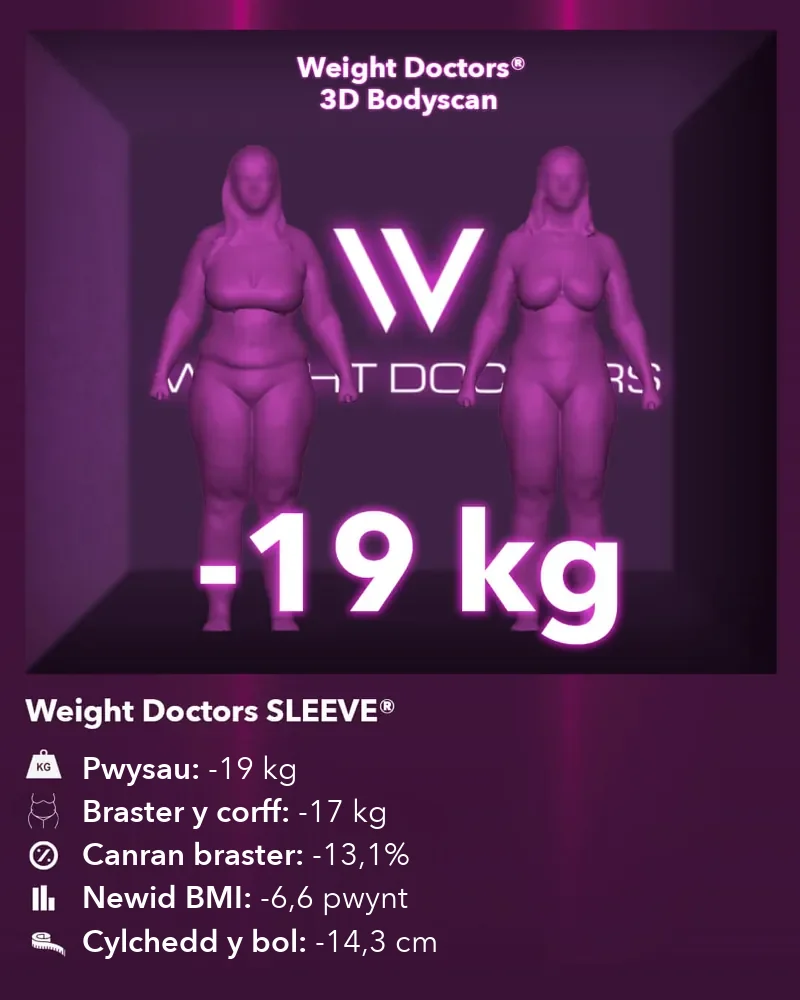 Weight Doctors® 3D Bodyscan cyn ac ar ôl: 19 kg yn llai gyda Weight Doctors SLEEVE®, 17 kg yn llai o fraster y corff