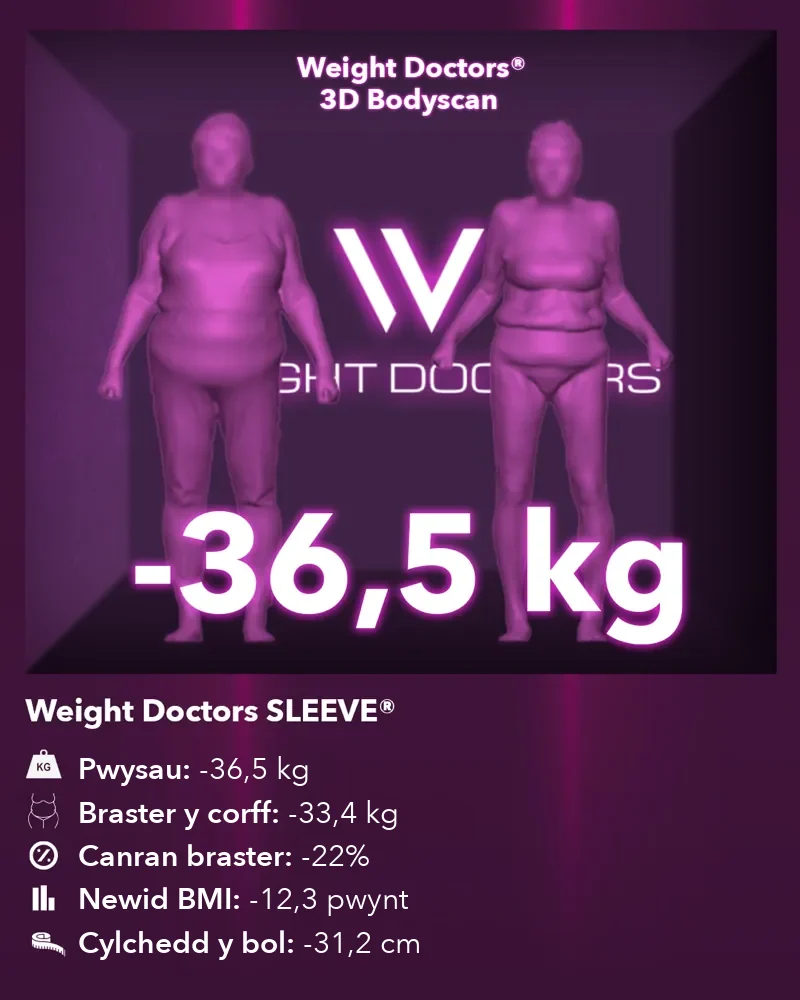 Weight Doctors® 3D Bodyscan cyn ac ar ôl: minws 36.5 kg gyda Weight Doctors SLEEVE®, braster y corff minws 33.4 kg