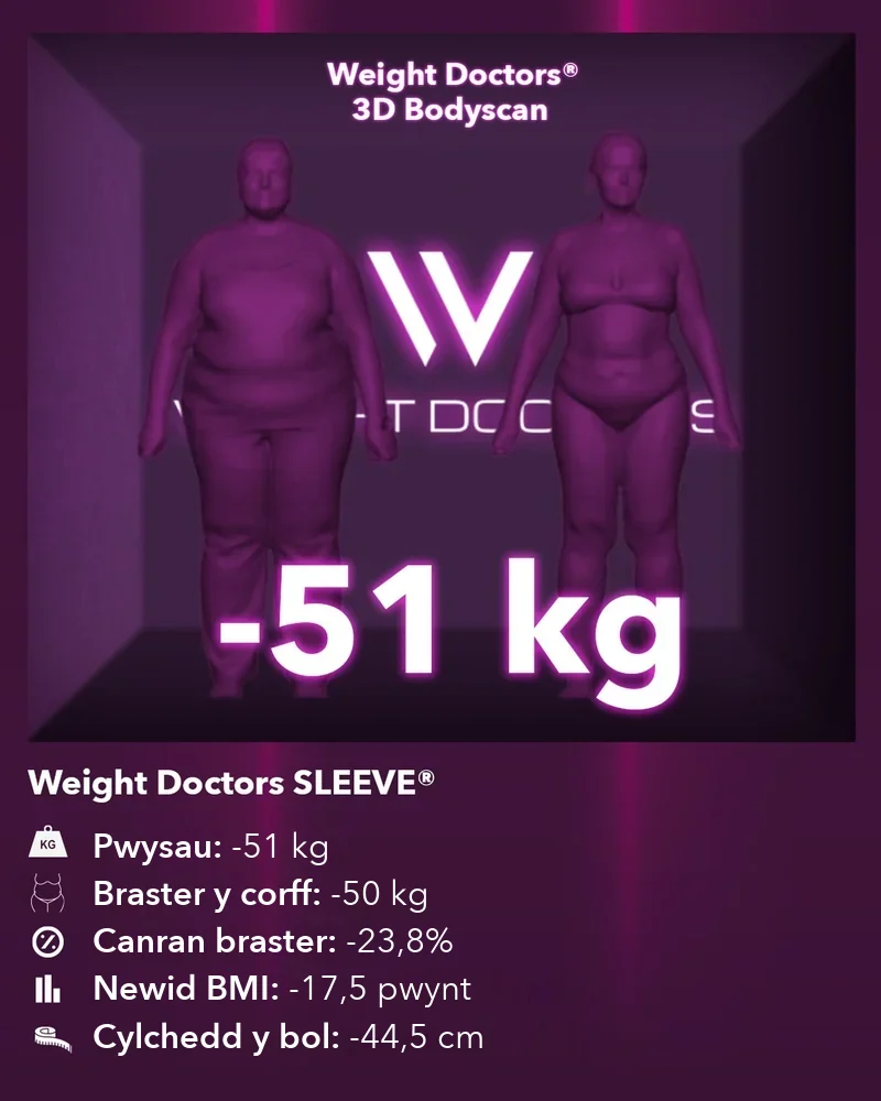 Weight Doctors® 3D Bodyscan cyn ac ar ôl: minws 51 kg gyda Weight Doctors SLEEVE®, braster y corff minws 50 kg