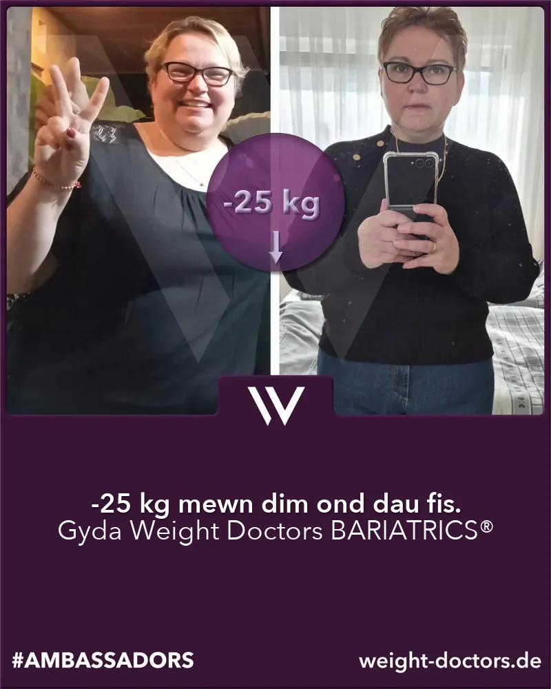 Weight Doctors® cyn ac ar ôl: claf 25 kg yn ysgafnach mewn dau fis, gyda Weight Doctors BARIATRICS®