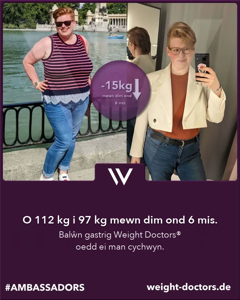 Weight Doctors® cyn ac ar ôl: cleifes o 112 kg i 97 kg mewn chwe mis, gyda’r Weight Doctors® BALŴN GASTRIG