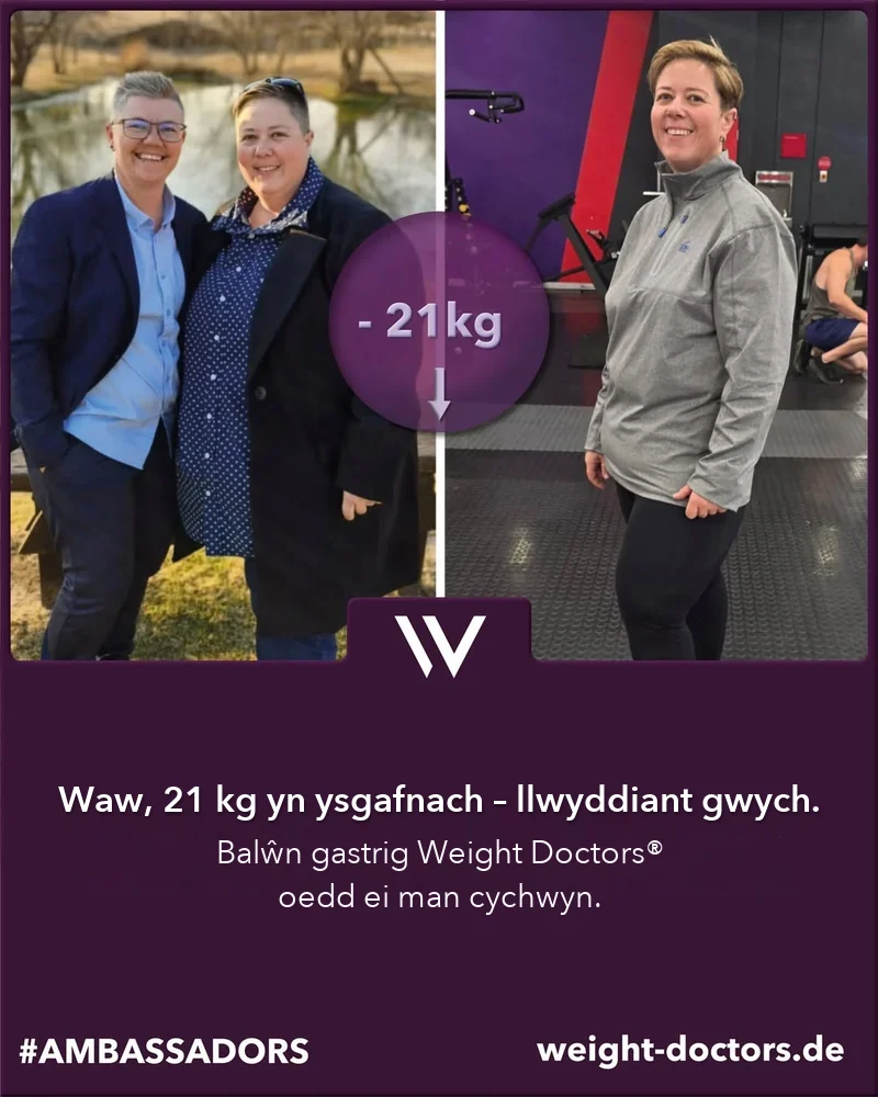 Weight Doctors® cyn ac ar ôl: Elli, 21 kg yn ysgafnach, gyda’r Weight Doctors® BALŴN GASTRIG