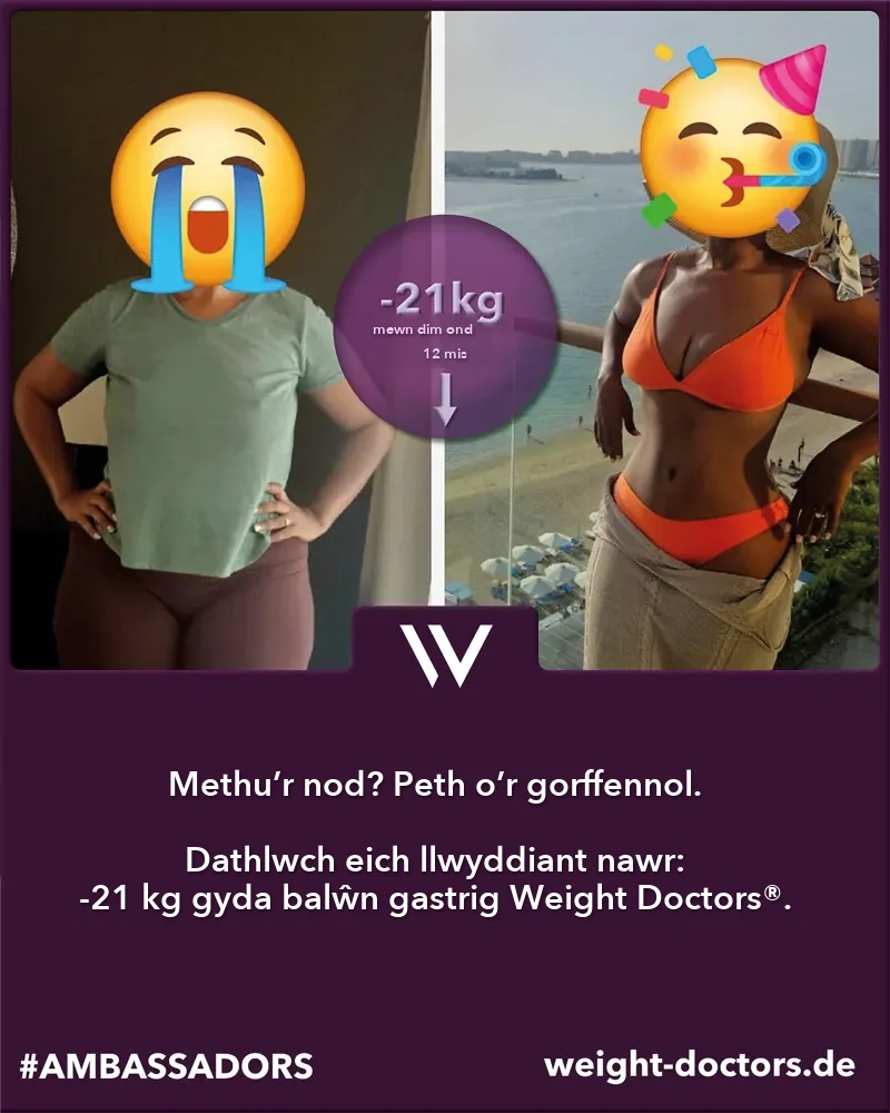 Weight Doctors® cyn ac ar ôl: claf gyda 21 kg yn llai mewn deuddeg mis, gyda'r Weight Doctors® BALŴN GASTRIG (wynebau wedi'u cuddio)