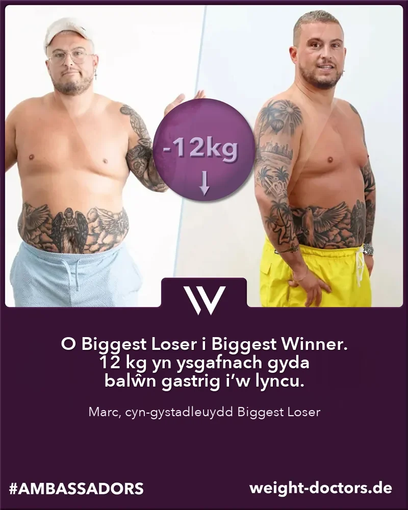Weight Doctors® cyn ac ar ôl: Marc, cyn-gystadleuydd ar “The Biggest Loser”, 12 kg yn llai gyda balŵn gastrig Allurion