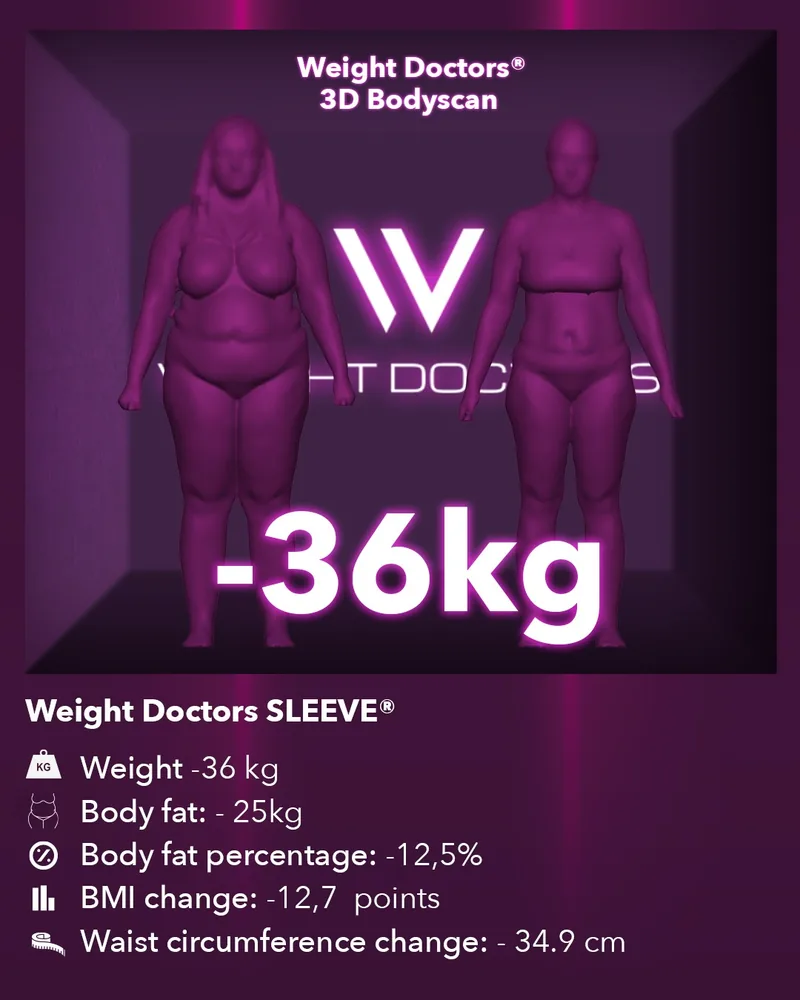 Weight Doctors® 3D Bodyscan before and after: minus 36 kg with Weight Doctors SLEEVE®, body fat minus 25 kg