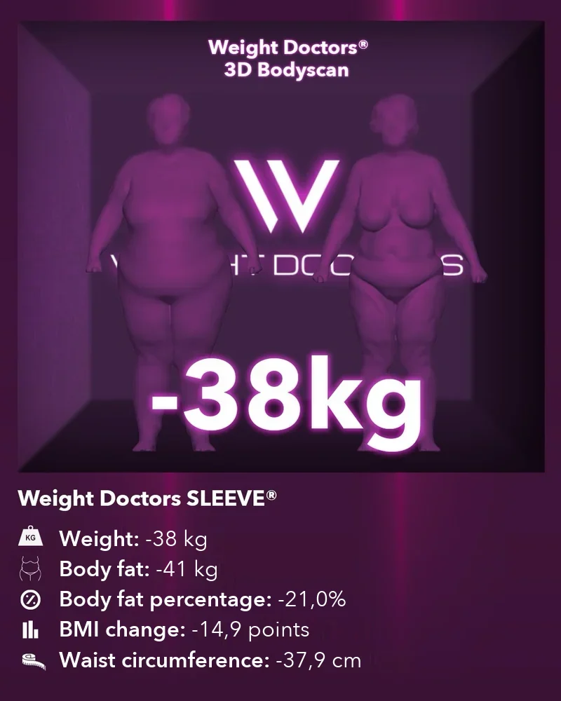 Weight Doctors® 3D Bodyscan before and after: minus 38 kg with Weight Doctors SLEEVE®, body fat minus 41 kg