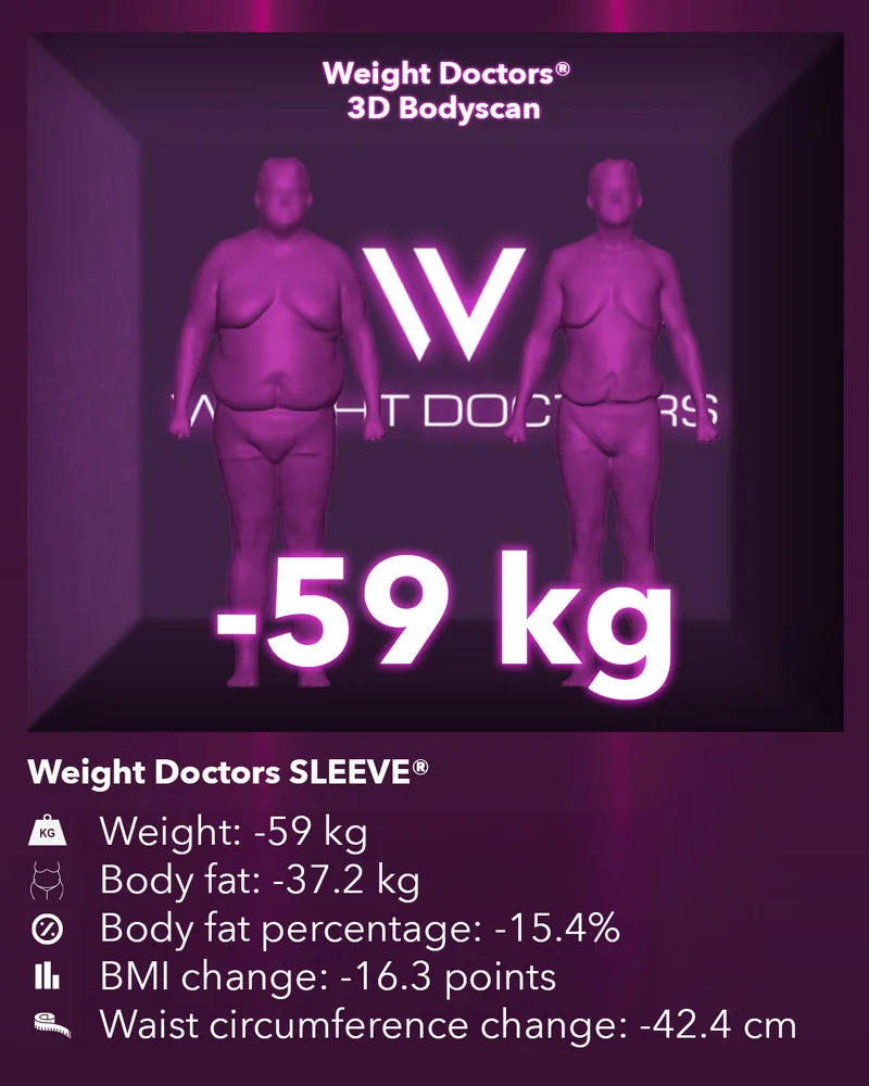 Weight Doctors® 3D Bodyscan before and after: minus 59 kg with Weight Doctors SLEEVE®, body fat minus 37.2 kg
