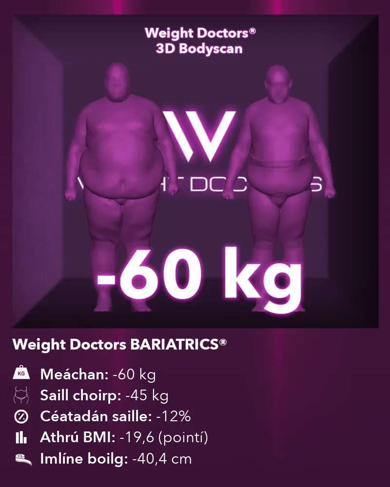 Weight Doctors® 3D Bodyscan roimh agus tar éis: lúide 60 kg le Weight Doctors BARIATRICS®, saill choirp lúide 45 kg