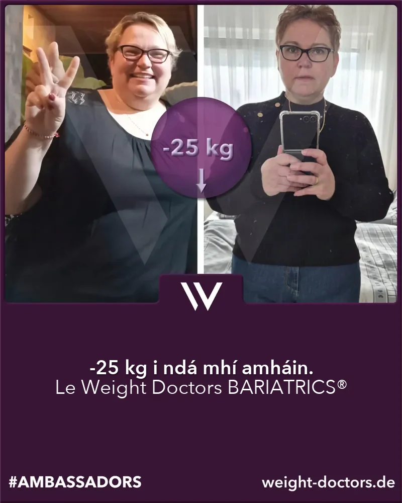 Weight Doctors® roimh agus tar éis: othar baineann 25 kg níos éadroime i gceann dhá mhí, le Weight Doctors BARIATRICS®