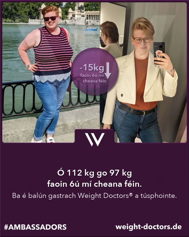 Weight Doctors® roimh agus tar éis: othar mná ó 112 kg go 97 kg i sé mhí, le Weight Doctors® BALÚN GASTRACH