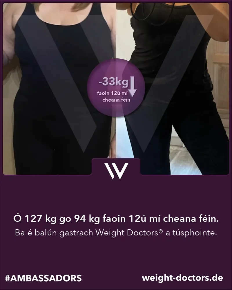 Weight Doctors® roimh agus tar éis: othar mná ó 127 kg go 94 kg i ndá mhí dhéag, le Weight Doctors® BALÚN GASTRACH