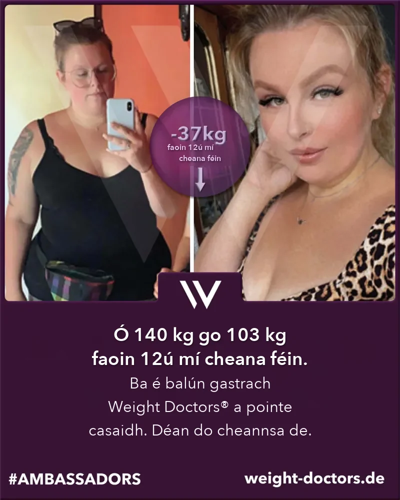 Weight Doctors® roimh agus tar éis: othar ó 140 kg go 103 kg i ndá mhí dhéag, leis an Weight Doctors® BALÚN GASTRACH