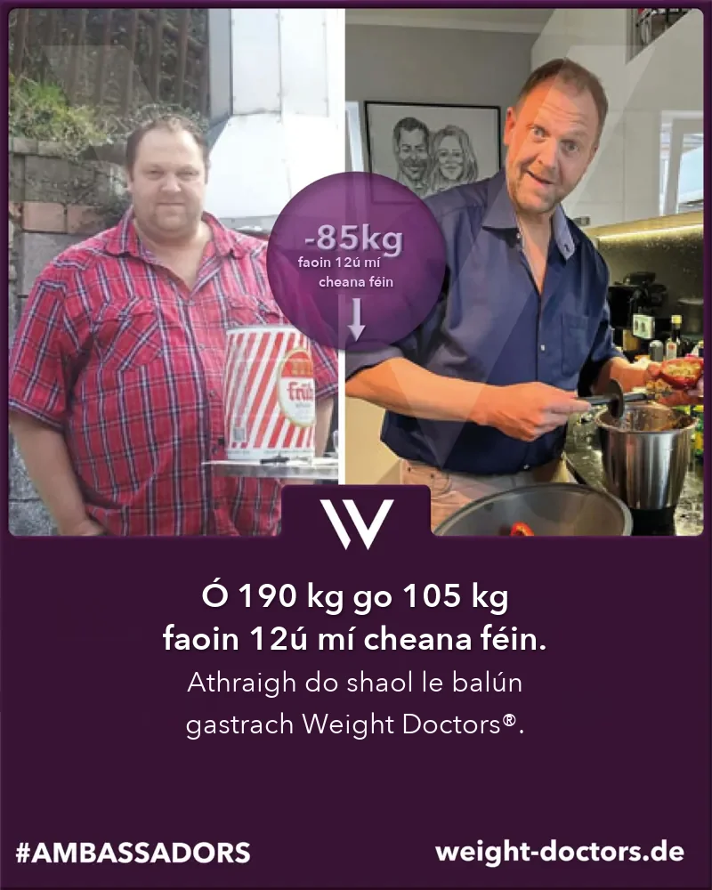 Weight Doctors® roimh agus tar éis: othar fir ó 190 kg go 105 kg i ndá mhí dhéag, le Weight Doctors® BALÚN GASTRACH