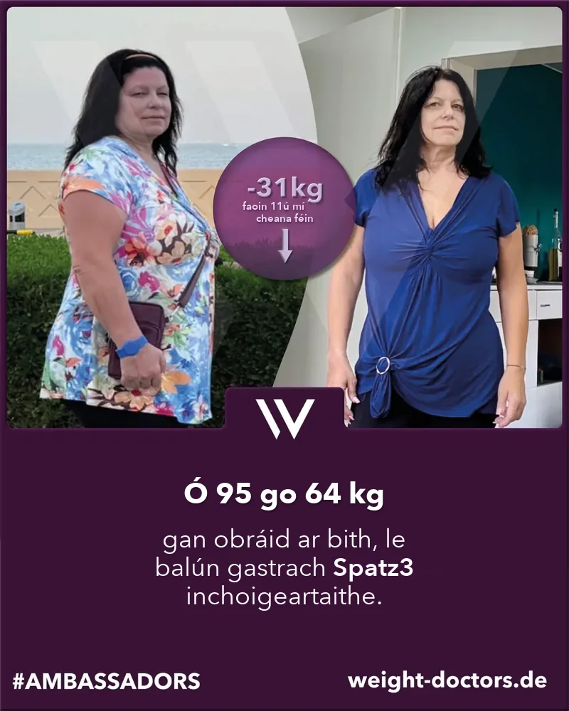 Weight Doctors® roimh agus tar éis: othar ó 95 go 64 cileagram gan obráid ar bith, leis an mbalún gastrach inchoigeartaithe Spatz3