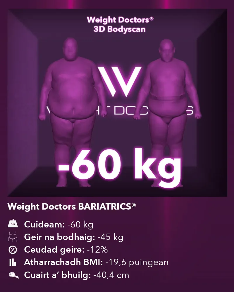 Weight Doctors® 3D Bodyscan ro agus às dèidh: 60 kg nas lugha le Weight Doctors BARIATRICS®, geir na bodhaig 45 kg nas lugha