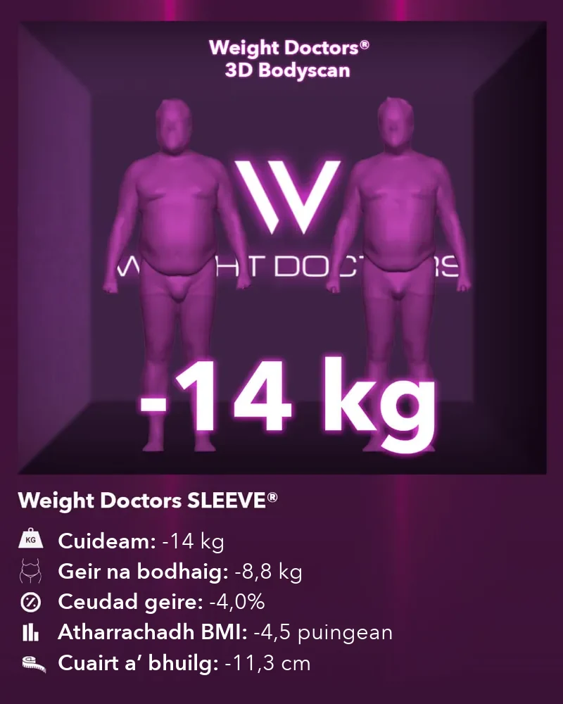 Weight Doctors® 3D Bodyscan ro agus às dèidh: 14 kg nas lugha le Weight Doctors SLEEVE®, geir na bodhaig 8.8 kg nas lugha