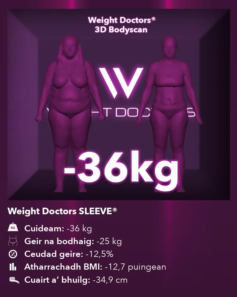 Weight Doctors® 3D Bodyscan ro agus às dèidh: 36 kg nas lugha le Weight Doctors SLEEVE®, geir na bodhaig 25 kg nas lugha