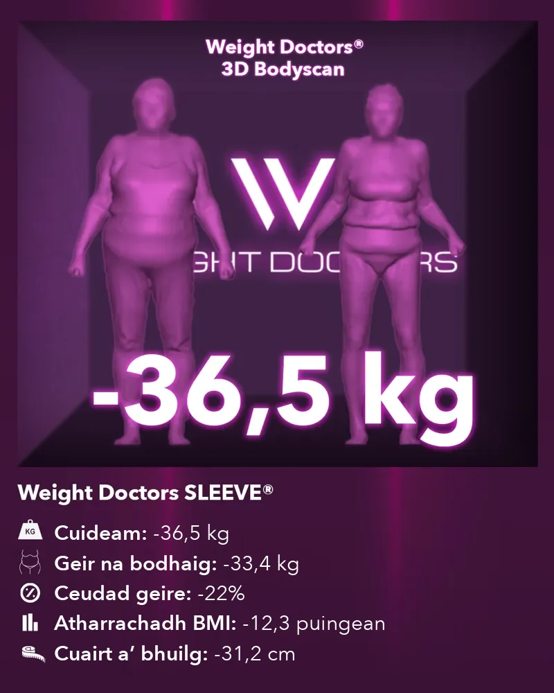 Weight Doctors® 3D Bodyscan ro agus às dèidh: 36.5 kg nas lugha le Weight Doctors SLEEVE®, geir na bodhaig 33.4 kg nas lugha