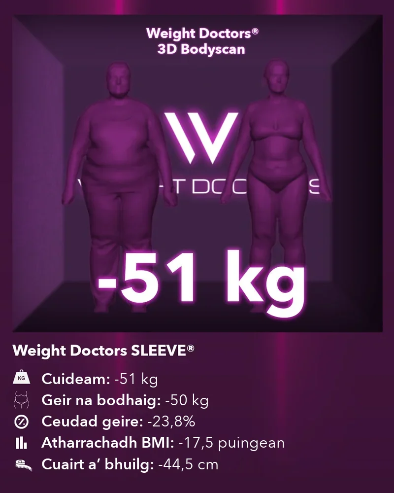 Weight Doctors® 3D Bodyscan ro agus às dèidh: 51 kg nas lugha le Weight Doctors SLEEVE®, geir na bodhaig 50 kg nas lugha
