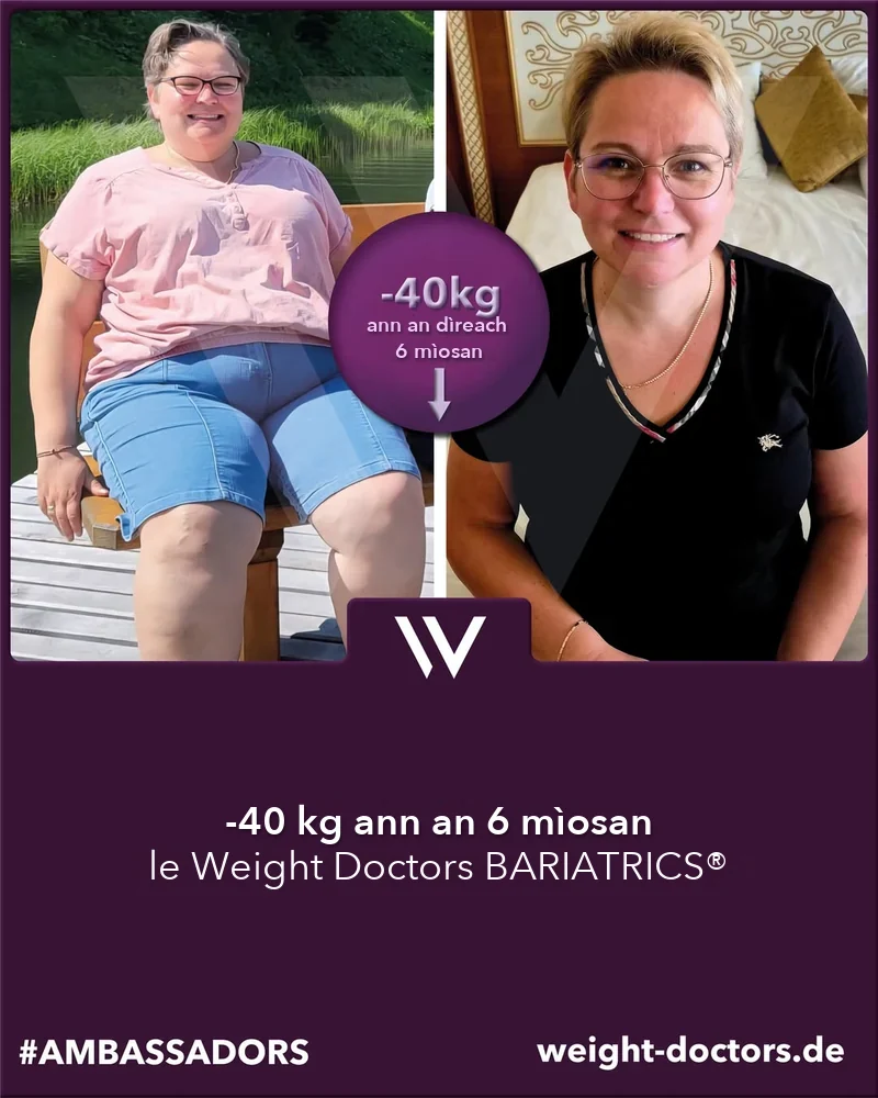 Weight Doctors® ro is às dèidh: euslainteach boireann 40 kg nas aotroime ann an sia mìosan, le Weight Doctors BARIATRICS®