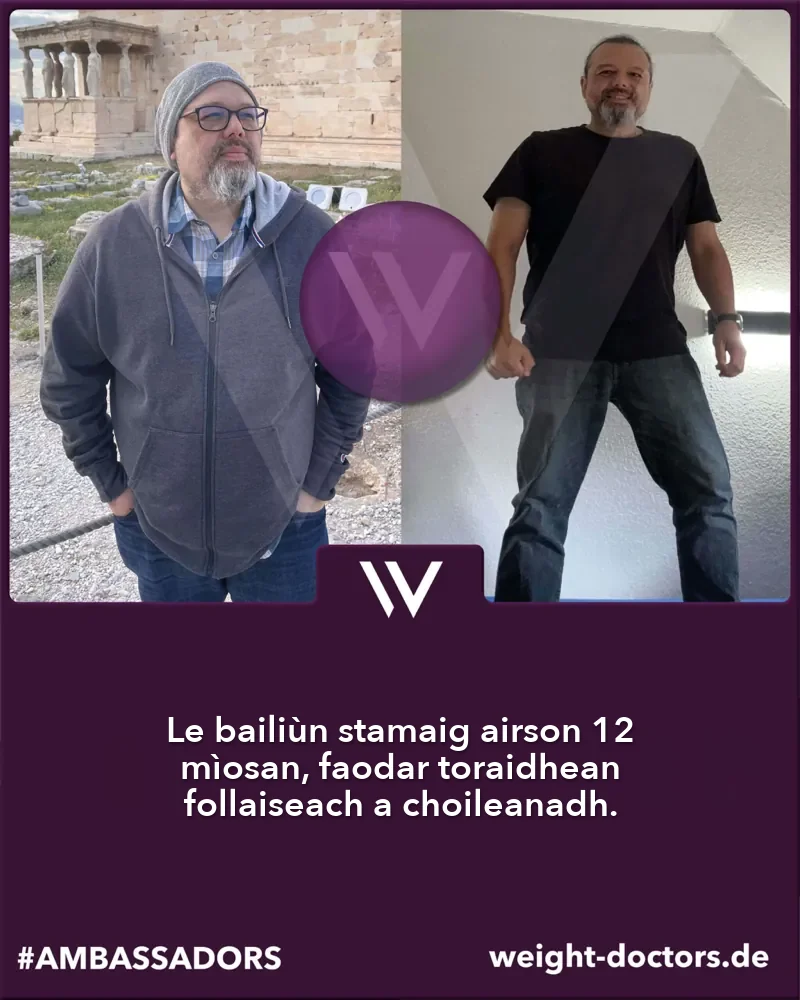Weight Doctors® ro agus às dèidh: euslainteach ro agus às dèidh dà mhìos dheug leis an Weight Doctors® BAILIÙN STAMAIG