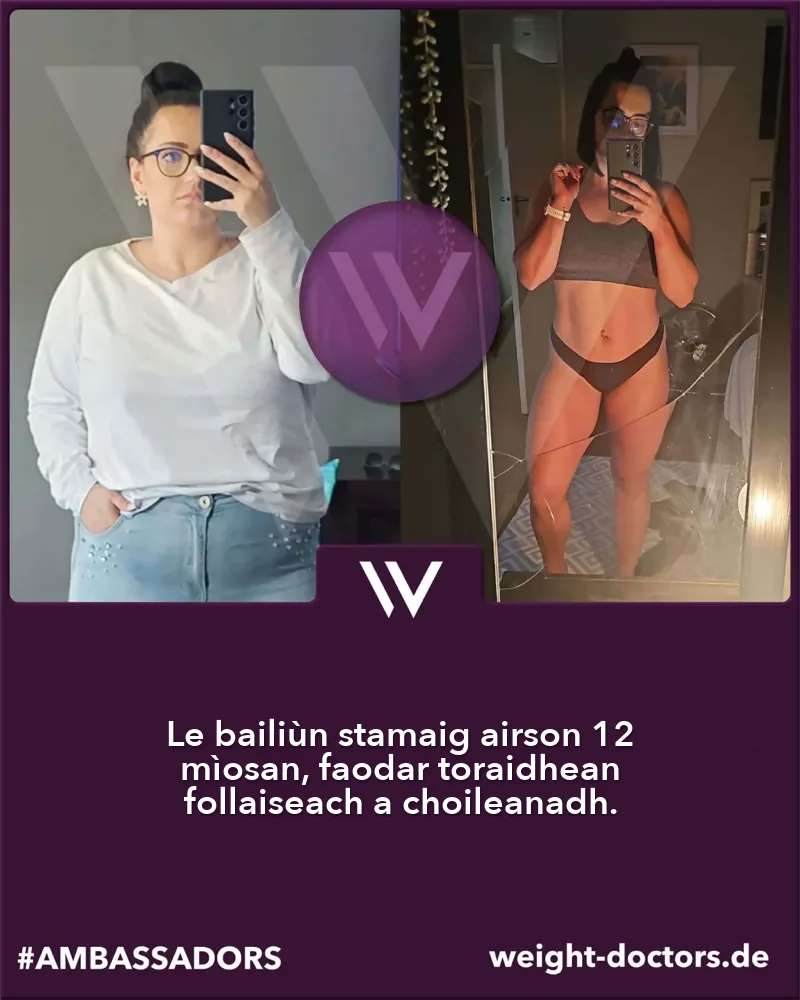 Weight Doctors® ro is às dèidh: euslainteach boireann ro agus às dèidh dà mhìos dheug le Weight Doctors® BAILIÙN STAMAIG
