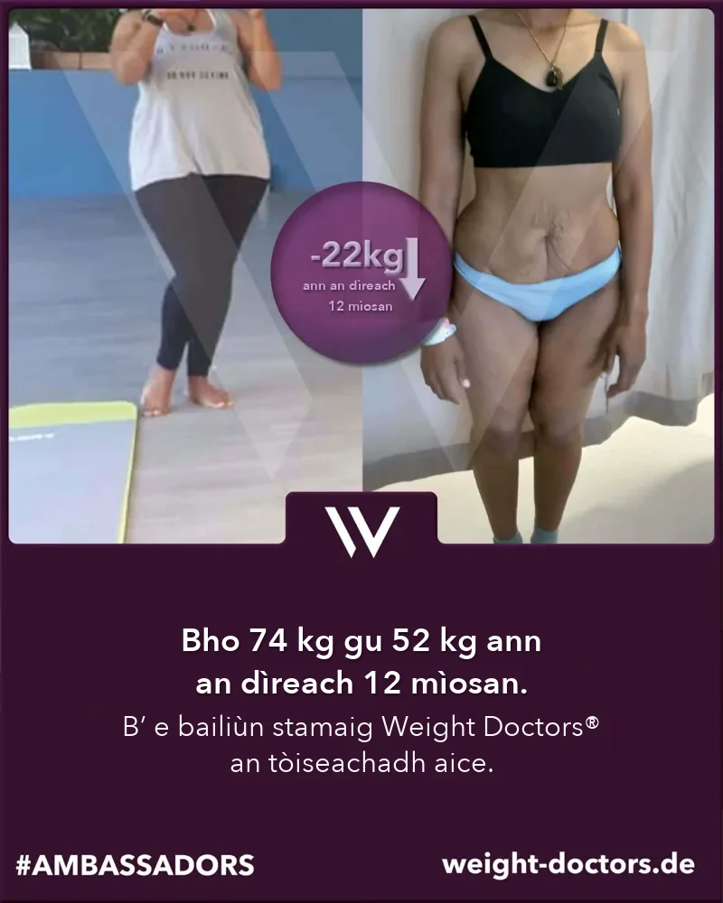 Weight Doctors® ro is às dèidh: euslainteach bho 74 kg gu 52 kg ann an dà mhìos dheug, le Weight Doctors® BAILIÙN STAMAIG