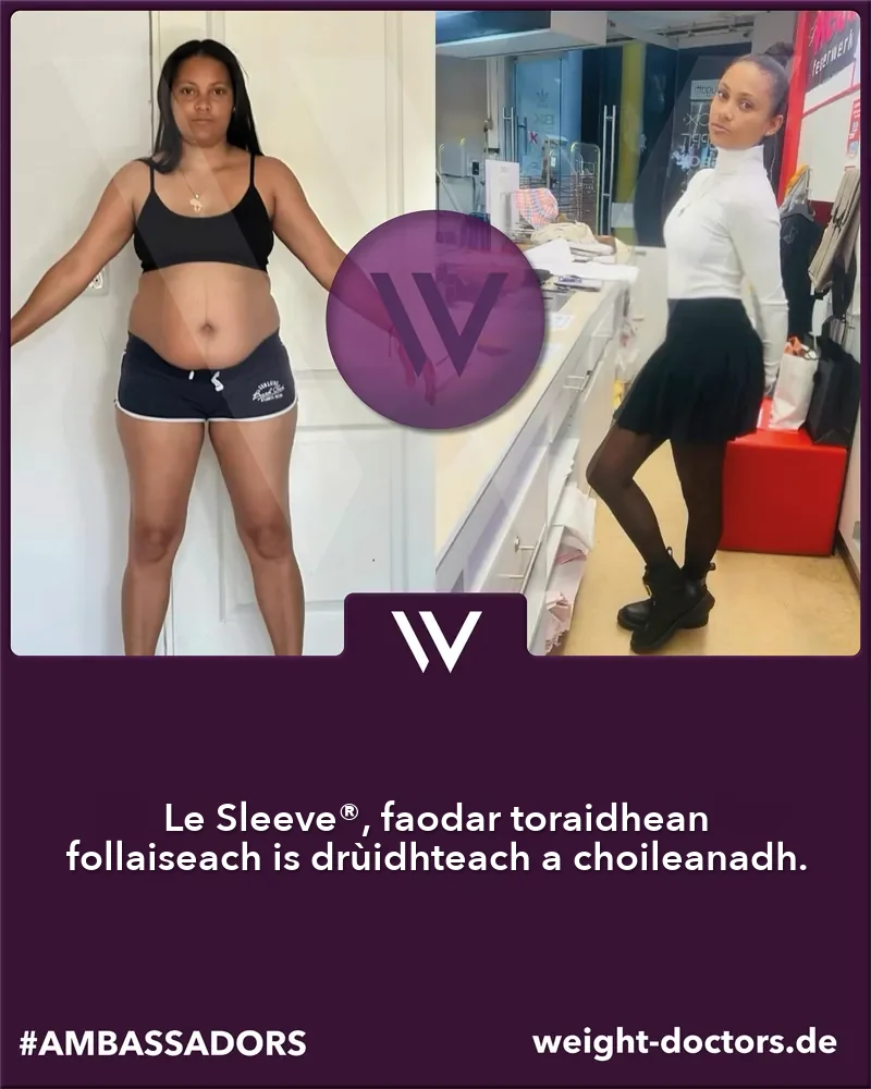 Weight Doctors® ro is às dèidh: euslainteach boireann ro agus às dèidh an Weight Doctors SLEEVE® aice