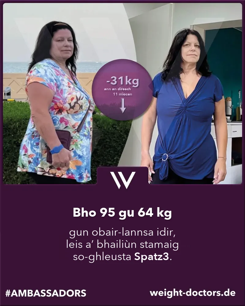 Weight Doctors® ro is às dèidh: euslainteach bho 95 gu 64 cileagram gu tur gun obair-lannsa, le bailiùn stamaig Spatz3 a ghabhas atharrachadh