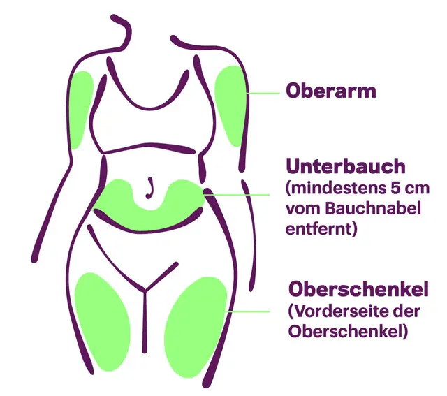Die möglichen Injektionsstellen: Oberarm, Unterbauch (mindestens 5 cm vom Bauchnabel entfernt) und die Vorderseite der Oberschenkel