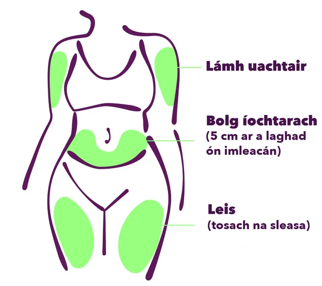 Na háiteanna instealltha féideartha: an lámh uachtarach, an bolg íochtarach (5 cm ar a laghad ón imleacán) agus tosach na sleasa