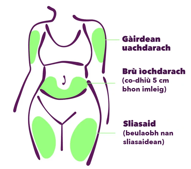 Na h-àiteachan in-stealladh comasach: an gàirdean uachdarach, a’ bhroinn ìochdarach (co-dhiù 5 cm bhon imleig) agus beulaobh nan sliasaidean