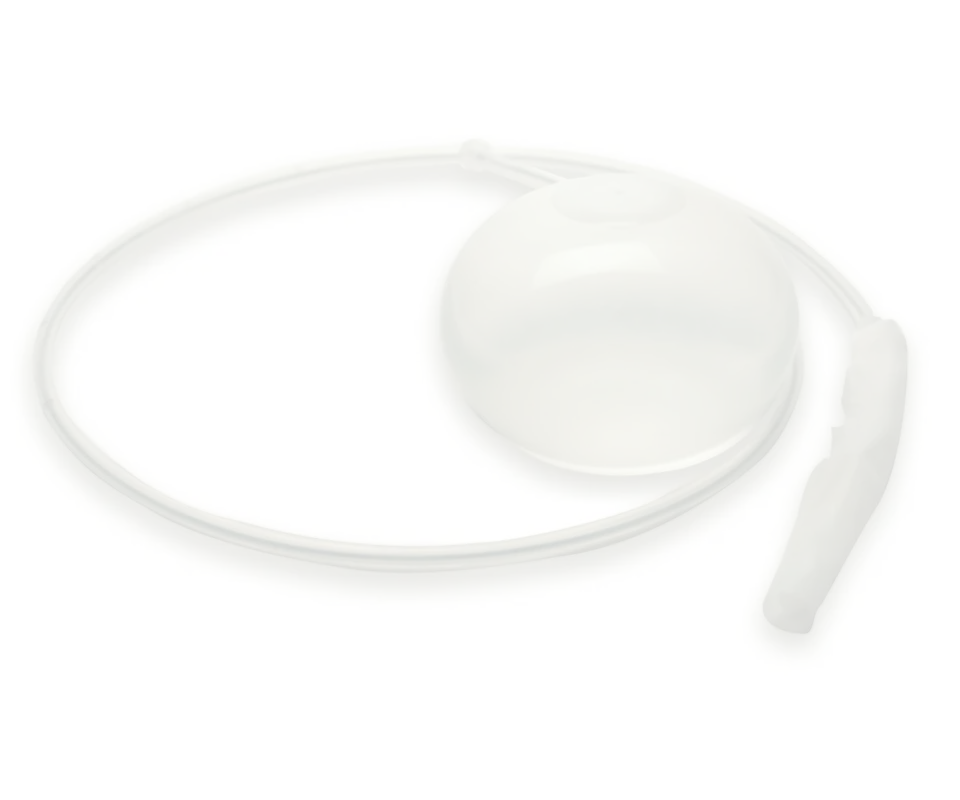 Gastric balloon for six months made of soft silicone with filling catheter